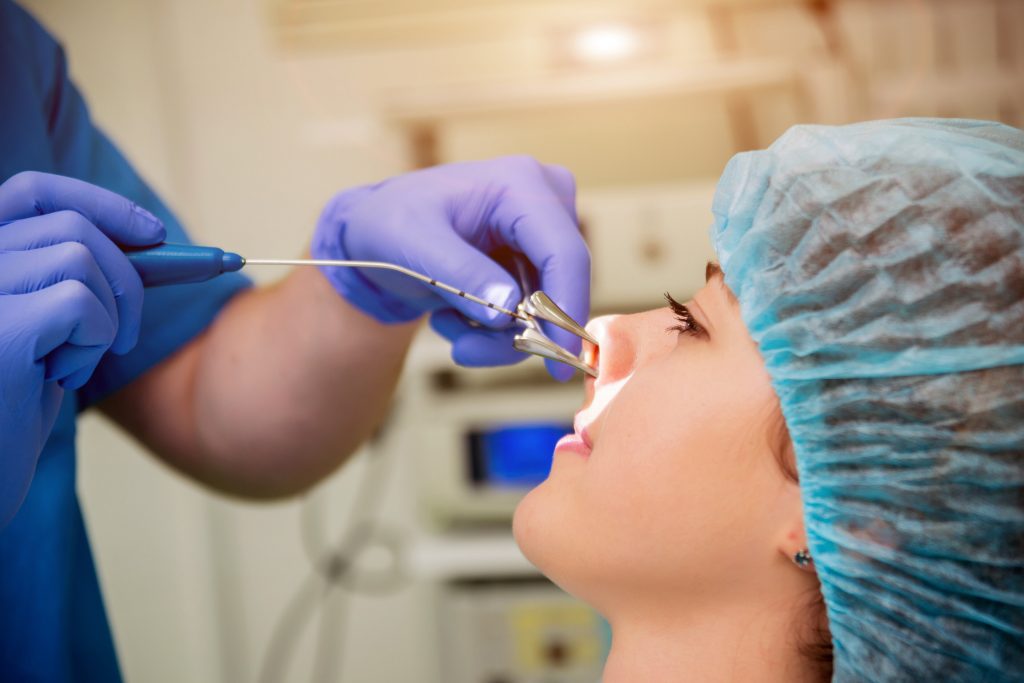 intros-hno-chirurgie